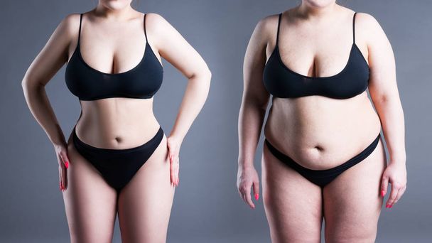 Woman's body before and after weight loss on gray background - Φωτογραφία, εικόνα