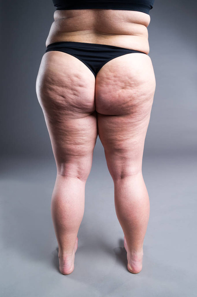 Fat female body with cellulite, overweight back, hips and buttocks on gray background, rear view - Fotografie, Obrázek