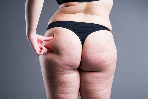 Fat female body with cellulite, overweight hips and buttocks on gray background - Fotó, kép