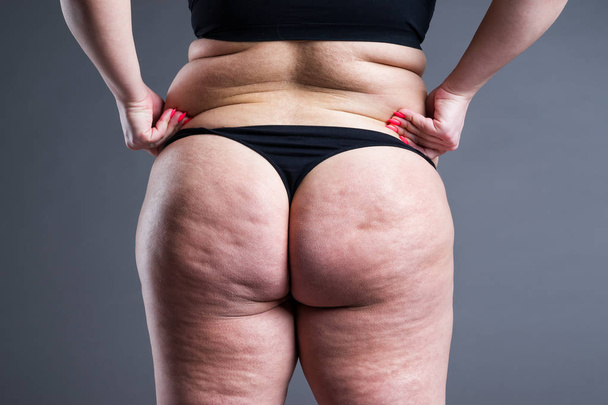 Fat female body with cellulite, overweight back, hips and buttocks on gray background, rear view - Foto, Imagem
