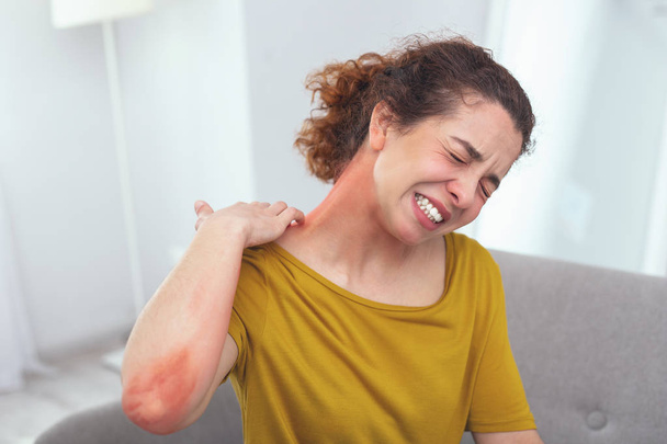 Fiatal hölgy tapasztalható elterjedésének bőrkiütés fertőzött - Fotó, kép