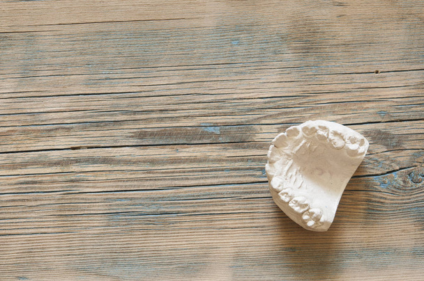 Sádrovce modelu Sádrový odlitek pro zubní stoličky v laboratoři na dřevěný stůl - Fotografie, Obrázek