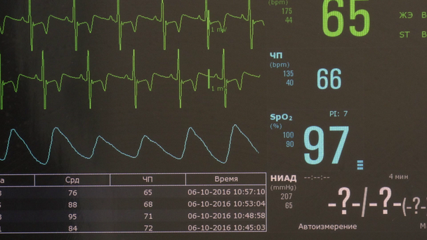 Cardiograma de ritmo de coração e imagem de pulso no monitor durante a operação
. - Filmagem, Vídeo