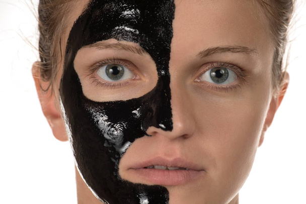 Gelukkig mooi meisje met acne glimlachend op een witte achtergrond in een cosmetische masker zwart - Foto, afbeelding