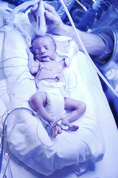 neonato irradiato con luce ultravioletta
 - Foto, immagini