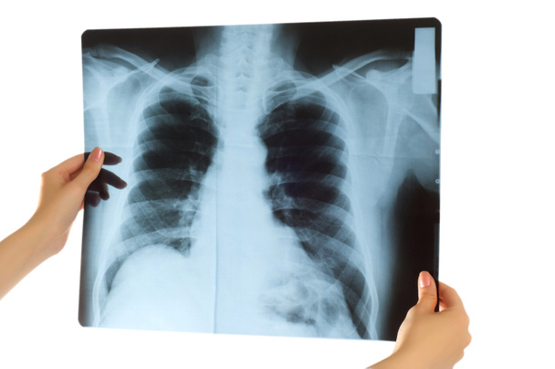 Dokter kijkt naar röntgenfoto - Foto, afbeelding
