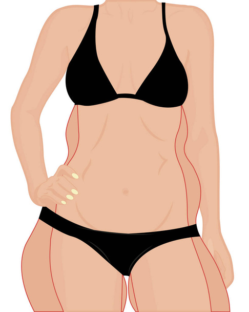 Correction woman figure. Get slim. Liposuction Vector illustration  - Vector, Image