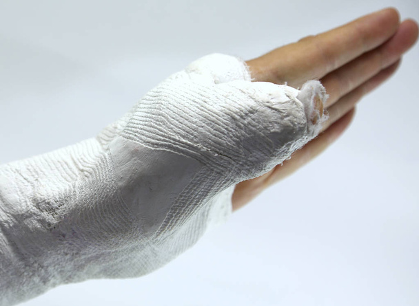Main du garçon blessé avec le membre cassé après l'accident de voiture
 - Photo, image