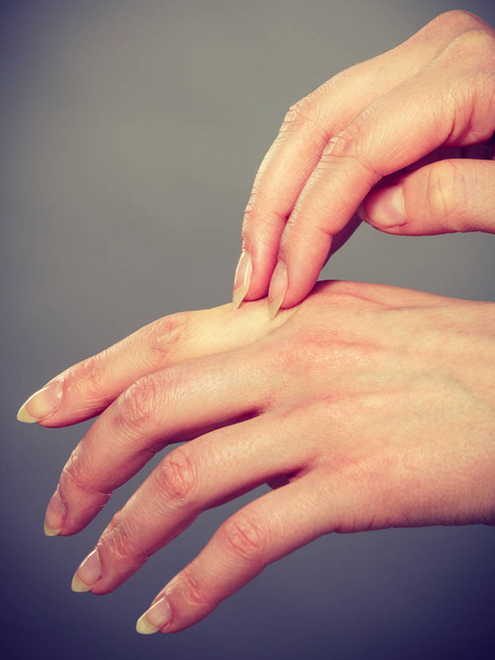 Dermatologia, allergia e problemi di salute. Giovane femmina graffiando il palmo pruriginoso con eruzione allergica
 - Foto, immagini