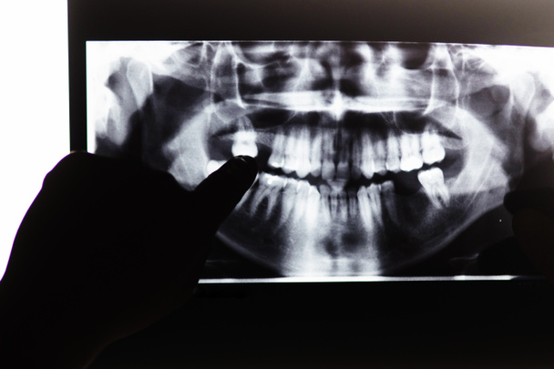 Image radiographique des dents et de la bouche pointant vers la main
 - Photo, image