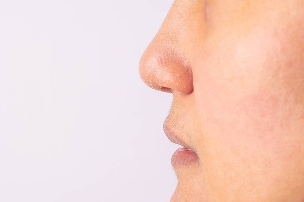 冬シーズンのクローズ アップにアトピー性皮膚炎乾燥した鼻と唇があるアレルギーの女性. - 写真・画像