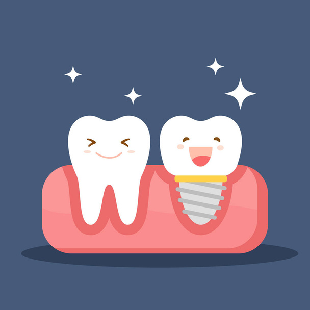 Dental implant and a normal tooth. Restoration in the oral cavity. Flat illustration on the theme of dentistry. Vector illustration isolated on blue background. - Vector, Image