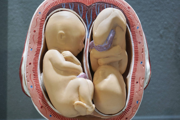 Modelo de embriones gemelos, feto para la educación en el aula
. - Foto, imagen