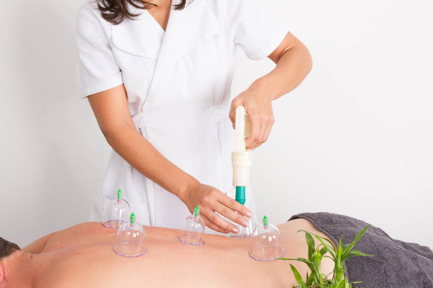 Cupping terapia spa mujer médico poner tazas de hombre paciente espalda
 - Foto, Imagen