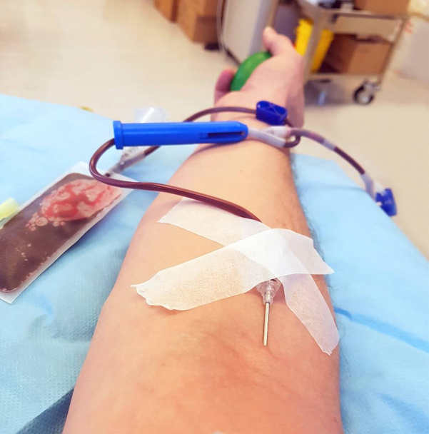 brazo donante de sangre durante la plasmaféresis en un centro hospitalario y la aguja penetró en la piel del brazo del hombre
 - Foto, imagen