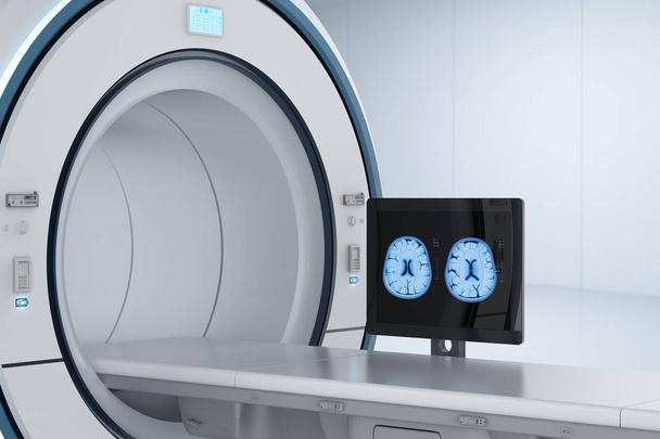 3D işleme bilgisayar monitör ekran x-ışını beyin MR'ı La - Fotoğraf, Görsel