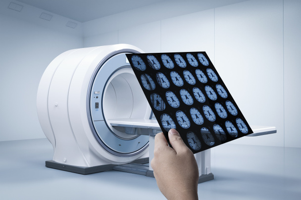 Röntgen filmi ile 3d tutan el MRI tarama makine ya da manyetik rezonans görüntüleme taraması devic oluşturma - Fotoğraf, Görsel