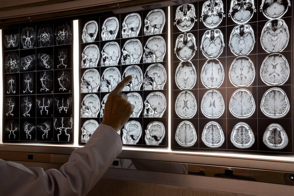 Doctor apuntando a la resonancia magnética del cerebro humano en la caja de luz para demostrar anatomía
 - Foto, imagen