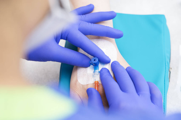 medical nurse with blue latex gloves inputs catheter to vein patient for drip of chemotherapy or another liquid medicine from cancer - Foto, Bild