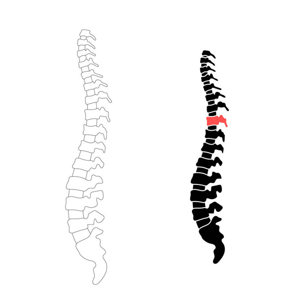 Vector human spine with pain - Вектор, зображення