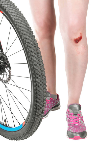 mulher com um joelho quebrado em uma bicicleta, close-up
 - Foto, Imagem
