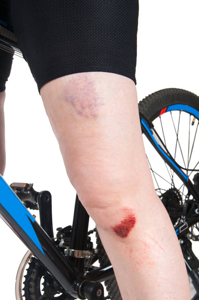 nő egy sérült térd-a kerékpár, közelkép - Fotó, kép