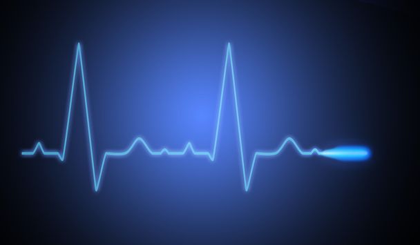 EKG azul
 - Foto, Imagem