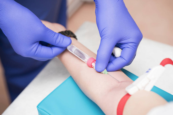 enfermeira caucasiana com brilho de látex azul está tomando sangue para análise ou pesquisa de veia paciente para frasco de plástico com agulha
 - Foto, Imagem