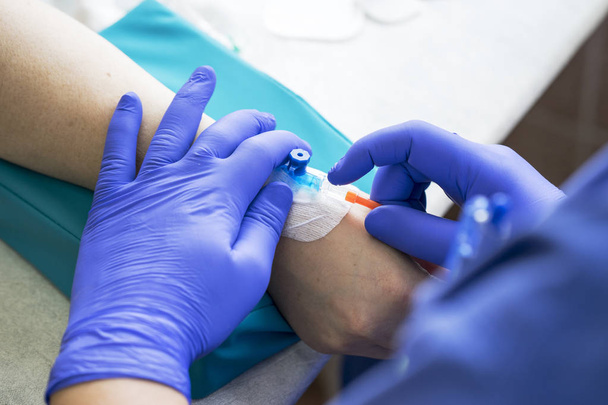 medical nurse with blue latex gloves inputs catheter to vein patient for drip of chemotherapy or another liquid medicine from cancer - Photo, Image
