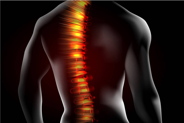 hombre espalda columna vertebral concepto médico vector ilustración
 - Vector, imagen