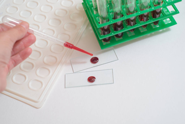 Scientist working with blood sample in laboratory. The doctor takes a test tube - Photo, image