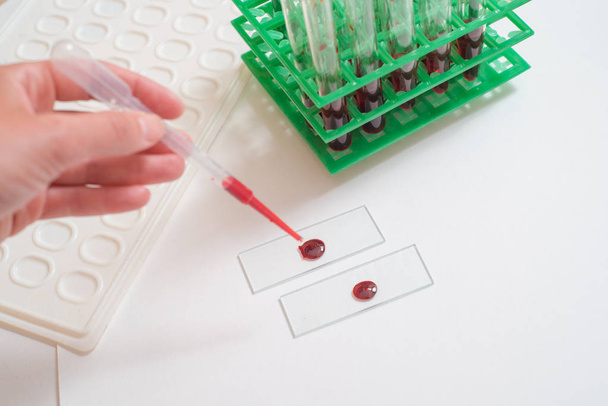 Scientist working with blood sample in laboratory. The doctor takes a test tube - Photo, image
