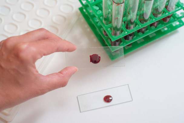 Scientist working with blood sample in laboratory. The doctor takes a test tube - Foto, afbeelding