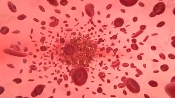 Trombo en el flujo de células sanguíneas
 - Metraje, vídeo