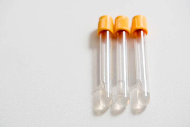 microbiological medical pipette medical test tubes in the genetic laboratory - 写真・画像