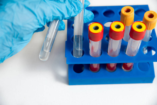 The doctor or laboratory assistant takes glass medical test tubes, in a blue glove, a blue tripod in the background. on a white background - Photo, image