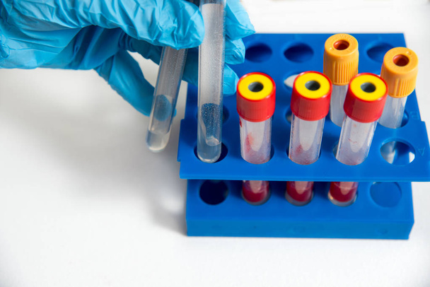 The doctor or laboratory assistant takes glass medical test tubes, in a blue glove, a blue tripod in the background. on a white background - Foto, Imagem