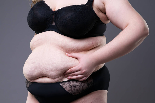 Obese woman with fat abdomen, overweight female stomach on gray studio background - Fotografie, Obrázek