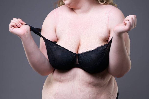 Stretch marks on a large natural breasts, obese woman with fat abdomen, overweight female body on gray studio background - Photo, Image