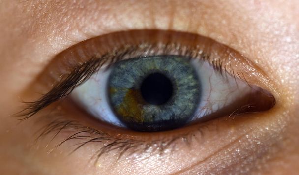 Интересный глаз с двумя цветами
 - Фото, изображение