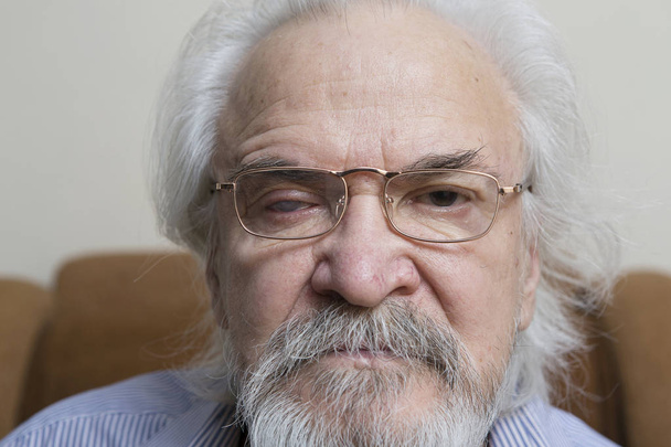 Un anciano enfermo solitario que sufre de enfermedades oculares, independientemente comprometido en el tratamiento conservador de la catarata y el glaucoma
. - Foto, imagen