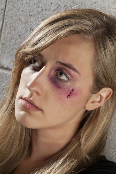 γυναίκα με μαυρισμένο μάτι και πληγή - Φωτογραφία, εικόνα