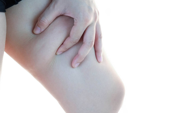 Vrouwelijke benen dijen met cellulitis. Huid probleem, lichaam zorg, overgewicht en dieet concept, diabetische risico facto - Foto, afbeelding