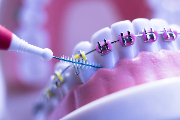 Inter dents brosse de nettoyage action de fil dentaire saine entre chaque dent avec des aligneurs d'accolades
. - Photo, image