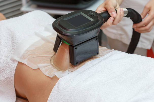 Woman getting cryolipolysis fat treatment procedure in professional cosmetic cabinet or spa center, closeup - Photo, image