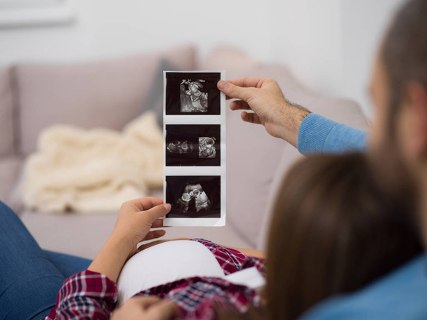 Young pregnant couple looking baby's ultrasound photo while relaxing on sofa at home - Foto, imagen