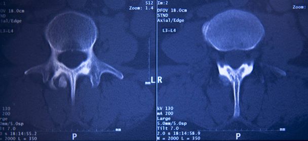Tıbbi hastane röntgen kalça omurga pelvis MRI Travmatoloji inceden inceye gözden geçirmek. - Fotoğraf, Görsel