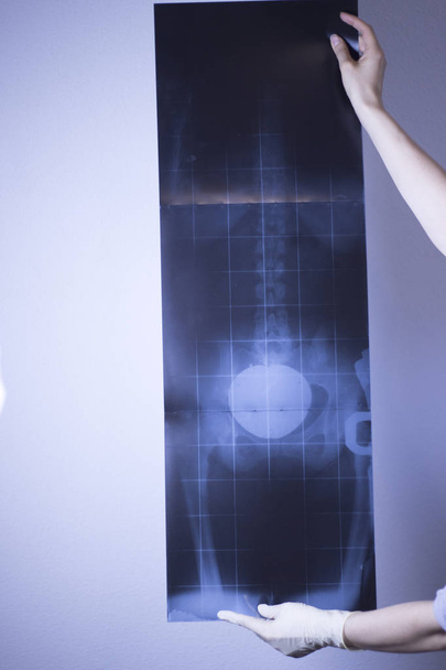 Рентген позвоночника и травматологическое сканирование бёдер также показало желудок и органы
. - Фото, изображение