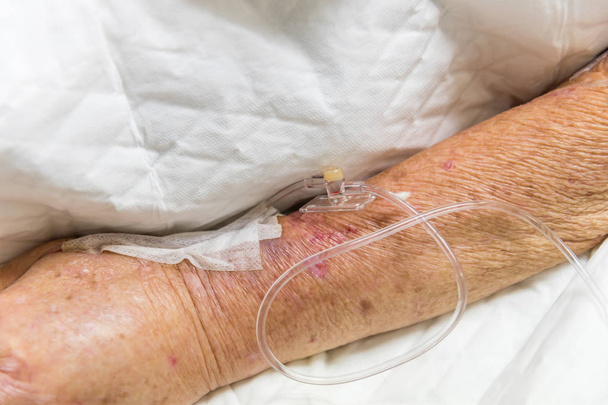 Paciente asiática idosas 80s com solução salina intravenosa em C-line ou A-line em uma mão de paciente idoso no leito do paciente em unidade de terapia intensiva (UTI.) quarto no hospital
. - Foto, Imagem