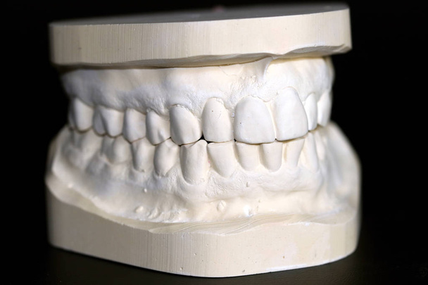 Modelo de dentes adultos fazendo de gesso
 - Foto, Imagem